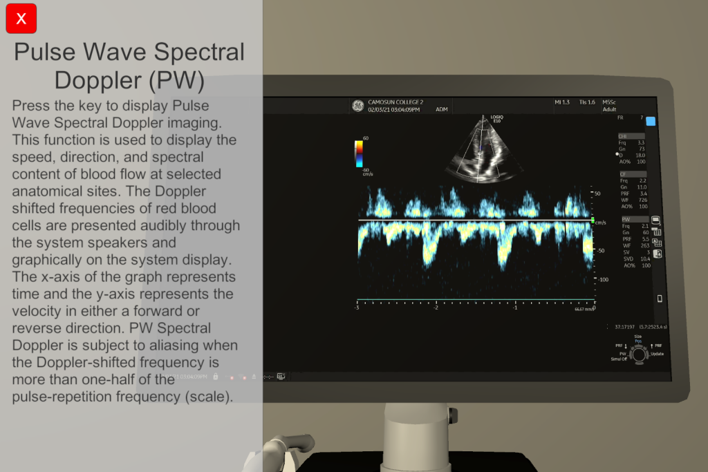A screen of a digital sonography machine, and a description on the function currently being used.